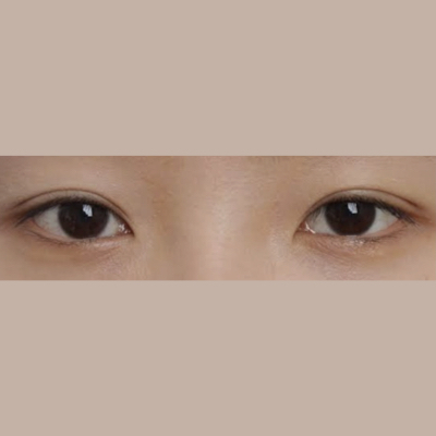 Preset Images