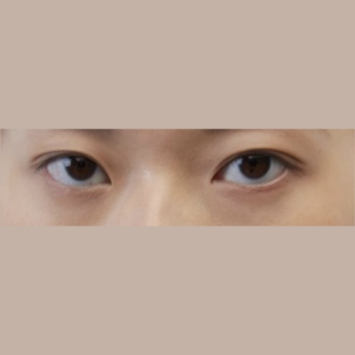Preset Images